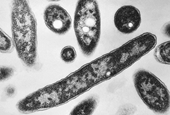 Second death reported in Legionnaires’ disease outbreak in New York City