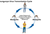 2025 Chikungunya outbreak: A global health challenge