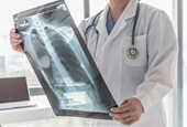Years After He Quit Smoking, a Lung Cancer Scan Saved His Life